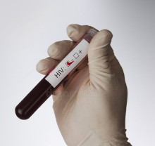 HIV检测结果呈阴性意味着什么？